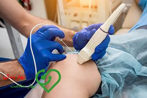 درمان واریس پا