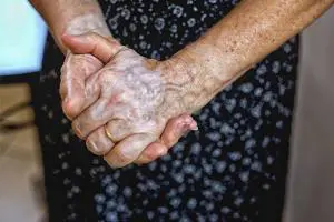 واریس دست چیست و چه نشانه هایی دارد؟