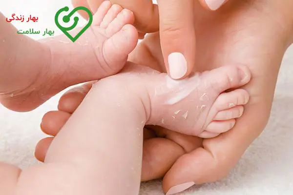   علت سوختگی پای نوزاد با پوشک چیست؟ 