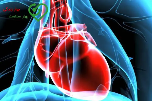 ایسکمی خفیف دیواره قدامی + داروهای ایسکمی قلبی