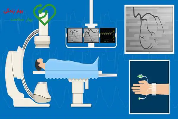 هزینه آنژیوگرافی قلب آپدیت تیر 1403