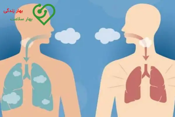 تنگی نفس عصبی چه مدت طول میکشد