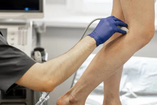   Sonography of leg varicose veins 