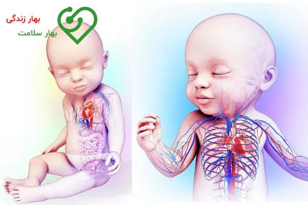 اکو قلب کودکان تهران