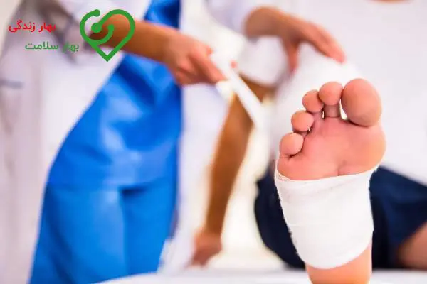 مدت زمان درمان زخم پای دیابتی