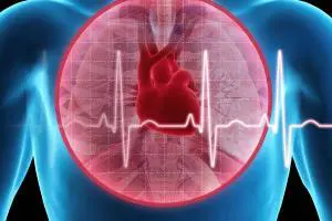 انژیوگرافی بعد از سکته قلبی