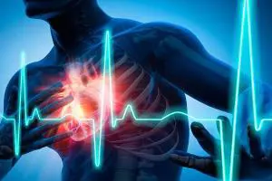 چه چیزی باعث سکته قلبی سریع میشود