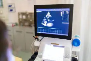 فوق تخصص اکو کاردیو گرافی