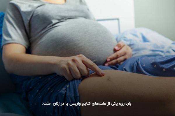بارداری؛ علت واریس پا در زنان 