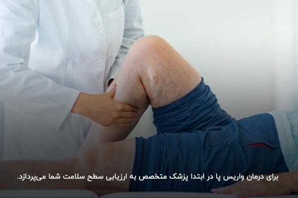 روش‌های درمان واریس پا توسط دکتر متخصص