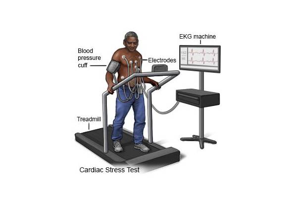  چگونه برای تست ورزش قلب آماده شوم؟ 
