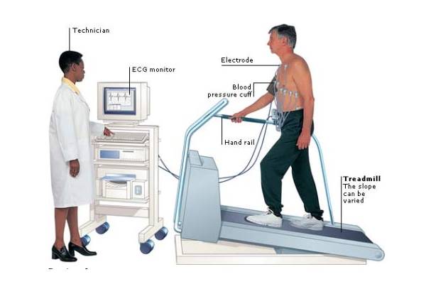  تست ورزش قلب چیست؟ 