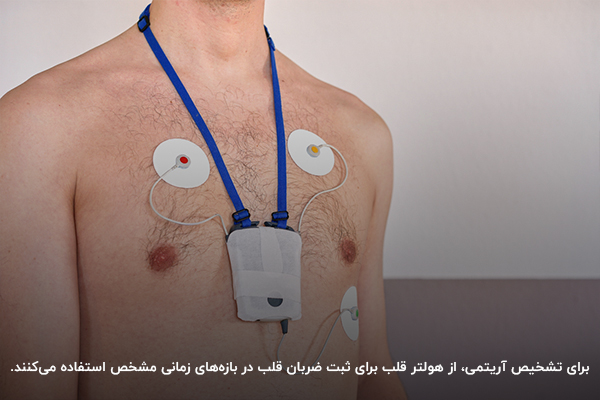 استفاده از هولتر قلب برای تشخیص آریتمی قلبی