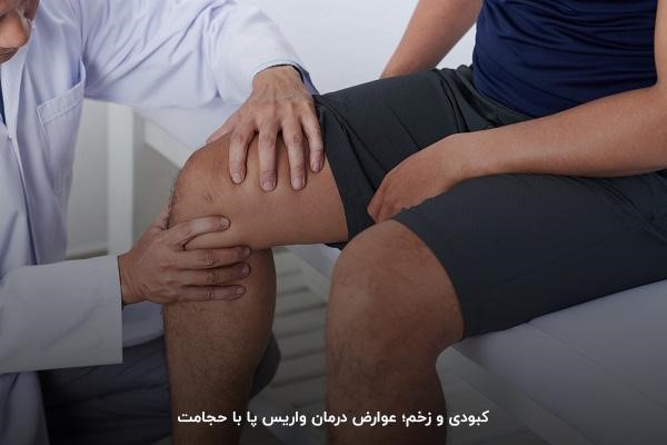 حالت تهوع و سرگیجه از مشکلات درمان واریس پا با حجامت