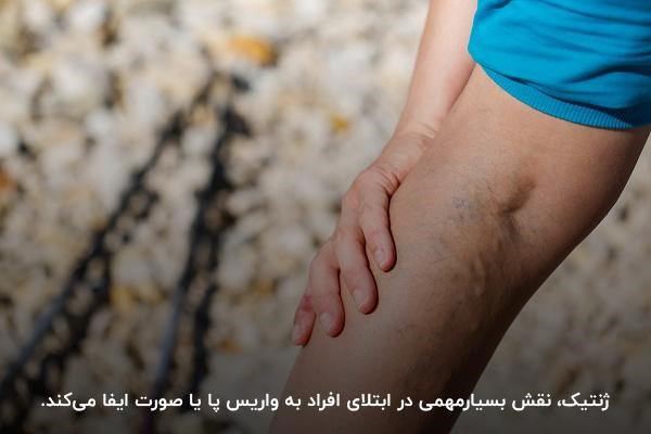 ژنتیک؛ مهم‌ترین علت واریس صورت