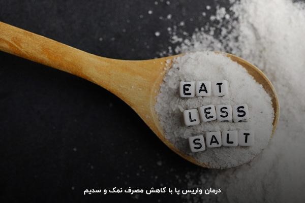 معجزه درمان واریس با کاهش مصرف نمک