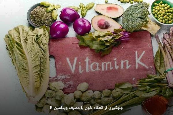 خواص ویتامین K برای پیشگیری از عارضه واریس