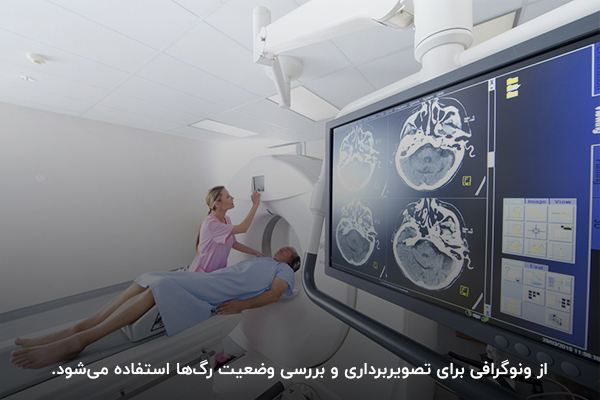 ونوگرافی مغز برای بررسی وضعیت رگ‌ها و جریان خون