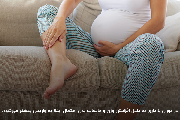 افزایش احتمال ابتلا به واریس طنابی در بارداری