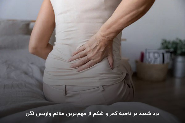 علائم واریس لگن؛ درد شدید در ناحیه پایین کمر و شکم