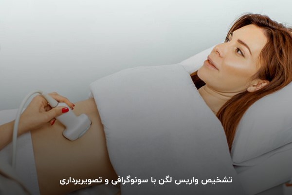 تشخیص واریس لگن از طریق روش‌های تصویربرداری