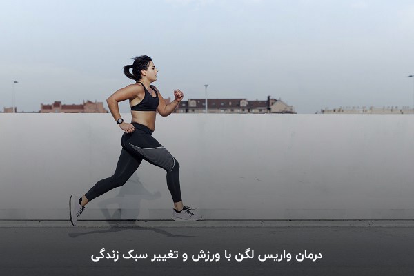 ورزش برای درمان واریس لگن؛ روش‌های مختلف درمان واریس لگن