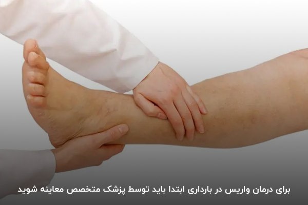 بهترین روش درمان واریس؛ مراجعه به پزشک