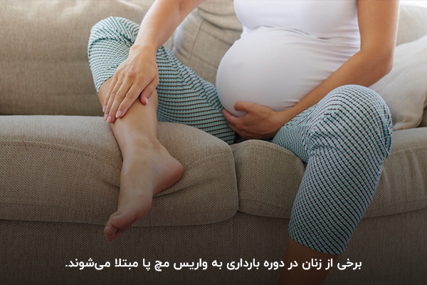 افزایش احتمال ابتلا به واریس مچ پا در دوره بارداری