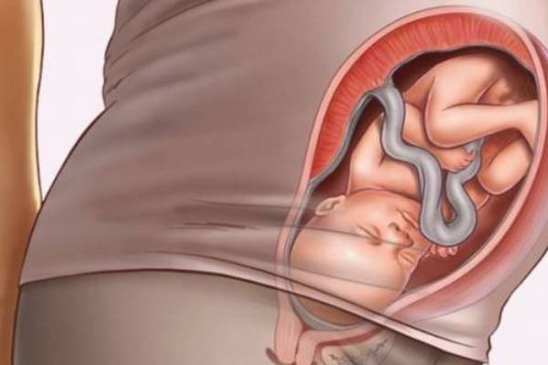 تغذیه ماه اول بارداری برای زیبایی جنین. مواد معدنی و ویتامین‌ها